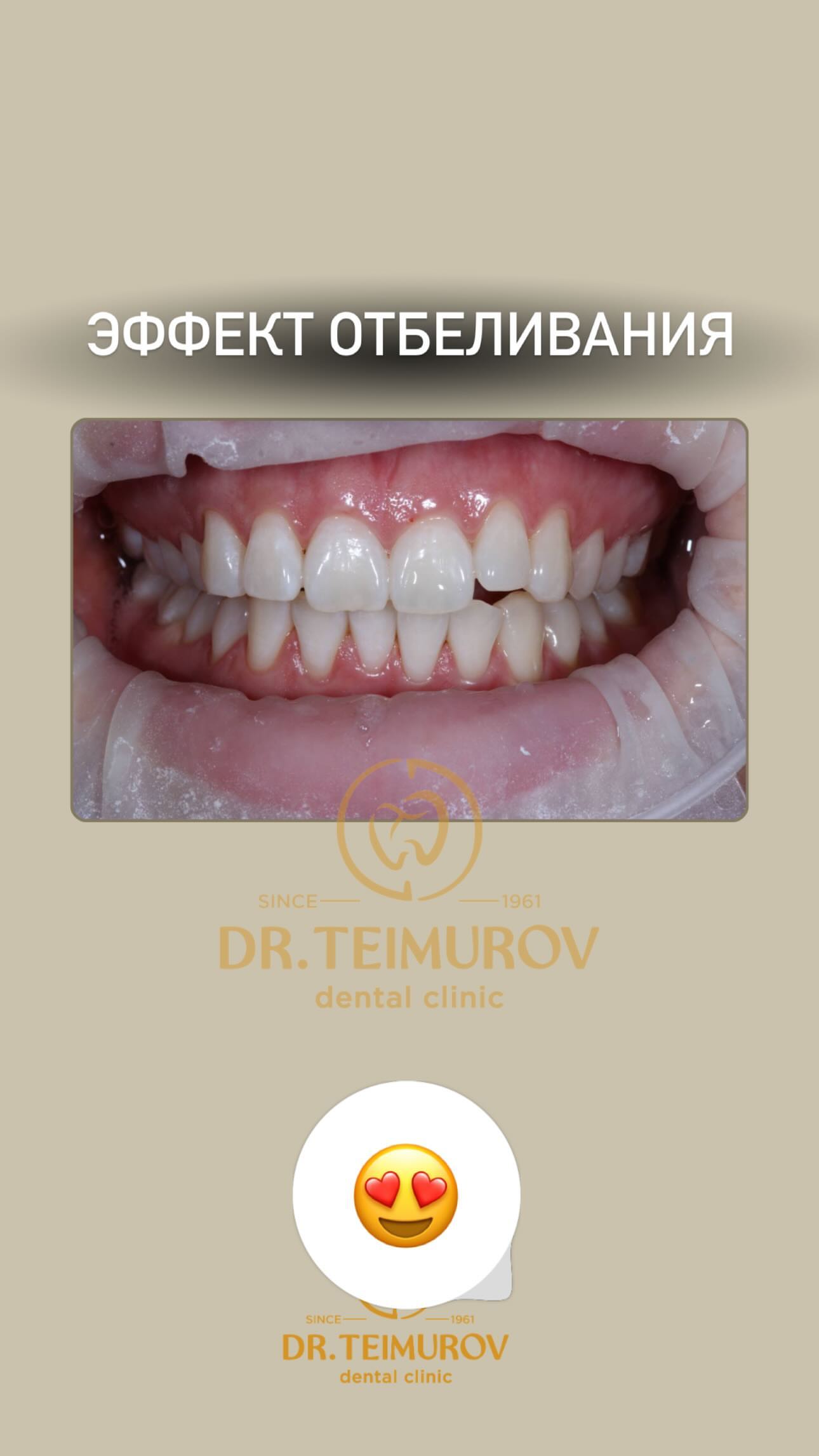 До лечения — случай 3