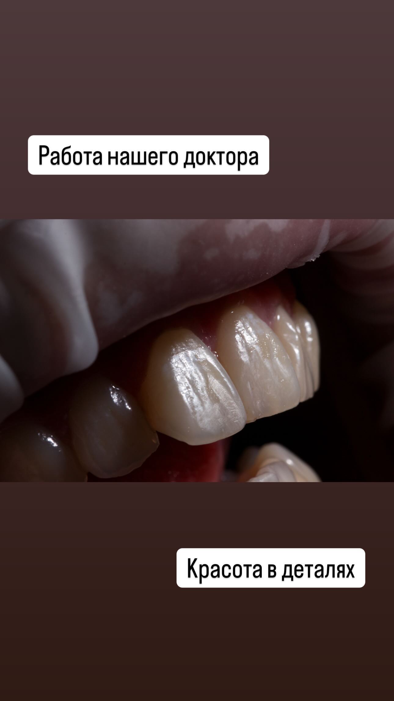 После лечения — случай 3